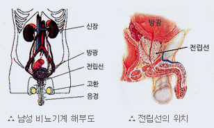 전립선암이란